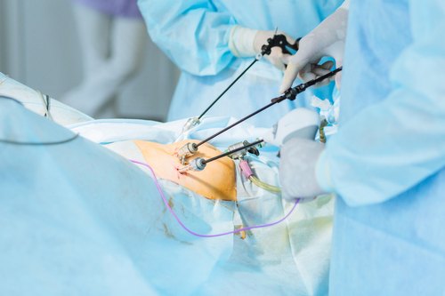 laparoscopic-surgery