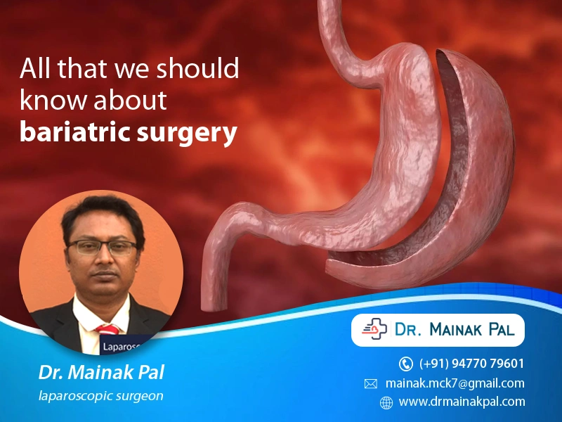 All that we should know about bariatric surgery