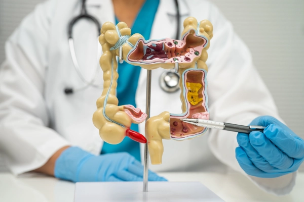 Colorectal Cancer Surgery