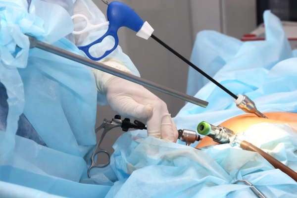 Laparoscopic GI Surgery