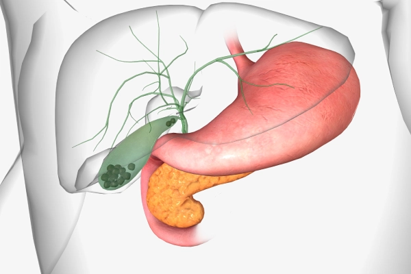 Laparoscopic Gallbladder Surgery