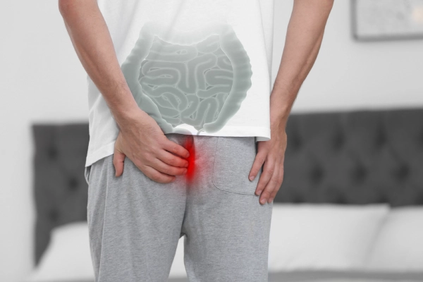 Piles Treatment