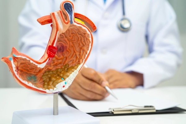 Stomach Cancer Surgery